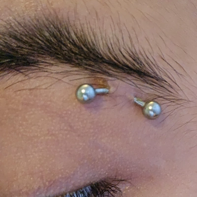 Rejet de piercing à l'arcade sourcilière.