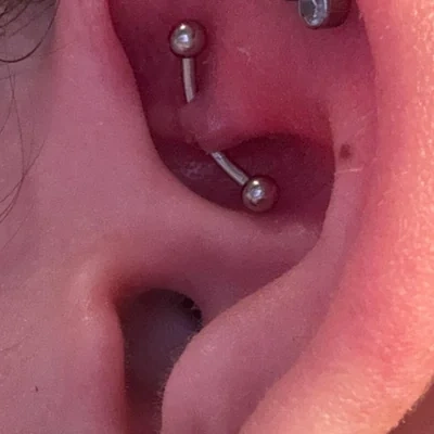 Rejet de piercing au rook (cartilage).