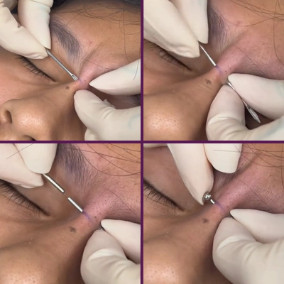 Pose Piercing Bridge Perceur Professionnel.