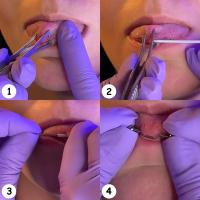 Piercing Snake Eyes - Pose par pierceur professionnel.
